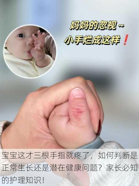 宝宝这才三根手指就疼了，如何判断是正常生长还是潜在健康问题？家长必知的护理知识！